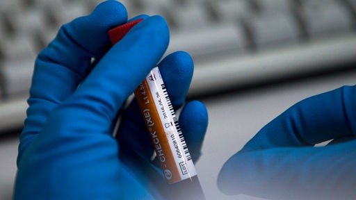 Kampf gegen Doping: Neues Verfahren - Nachweis von Steroiden auch im Blut