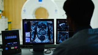  Ein Mitarbeiter betrachtet in einem Kontrollraum des Deutschen Krebsforschungszentrum (DKFZ) auf einem Monitor das Querschnittsbild einer Prostata.