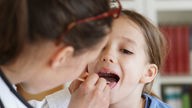 Ein Kind wird im Mund- und Rachenrauch von einer Ärztin untersucht