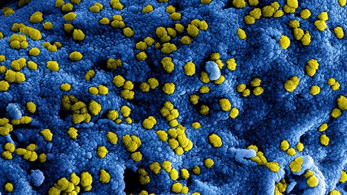 Mikroskopische Aufnahme des MERS-Virus