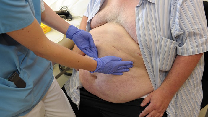 Osoba sa viškom kilograma na lekarskom pregledu