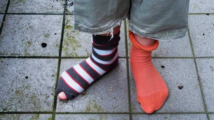 dete sa različitim čarapama od kojih je jedna pocepana
