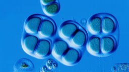 Mikroaufnahme von Cyanobakterien, sie zählen zu den ältesten Lebensformen überhaupt.