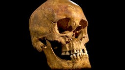 Der im September 2012 gefundene Schädel von Richard III.