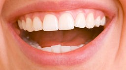 Strahlend weiße Zähne in einem lachenden Mund