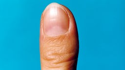 Das Bild zeigt einen ausgestreckten Daumen und den Fingernagel.