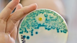 Multiresistente Keime auf einer Petrischale