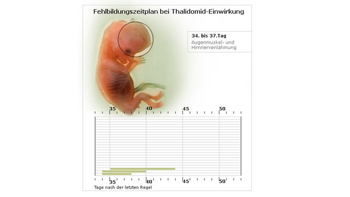 Embryo und Ausschnitt eines Zeitstrahls