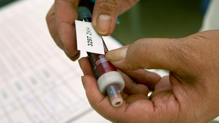 Eine Arzthelferin beklebt eine Blutprobe mit einem Erkennungsaufkleber