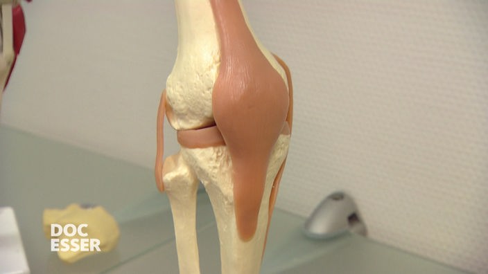 Das Bild zeigt das Modell eines Knie-Gelenks.