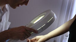 Ein Hautarzt schaut sich mit eine beleuchteten Lupe den Arm eines Patienten an