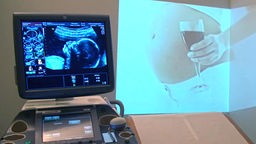 Ultraschallbild und Projektion einer Schwangeren mit Rotweinglas