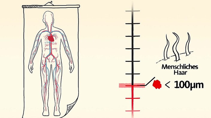 Illustration: Mikroplastik im Körper