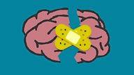 Illustration: gespaltenes Gehirn mit Pflaster