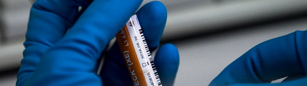 Kampf gegen Doping: Neues Verfahren - Nachweis von Steroiden auch im Blut