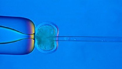 Die Chromosomen im Zellkern einer Eizelle werden im Rahmen des Zellkerntransfers waehrend des Klonens entfernt