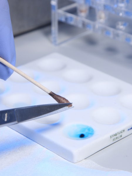 Spurenträger werden auf DNA-Spuren untersucht