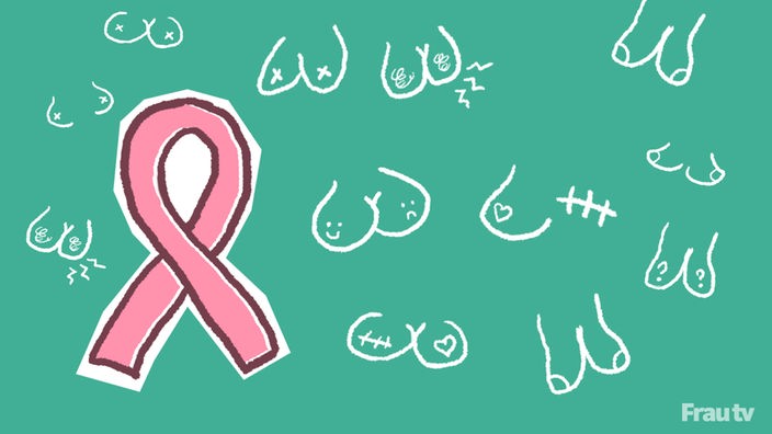 Diagnose Brustkrebs: und jetzt? Illustration von verschiedenen Brüsten