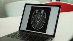 Das Bild zeigt einen Laptop auf einem Tisch. Auf dem Bildschirm ist ein CT-Scan zu sehen. 