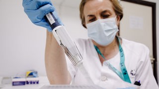 Eine Krankenschwester bereitet im Krankenhaus Ramon y Cajal in Madrid einen PCR-Tests zur Erkennung des Affenpockenvirus vor
