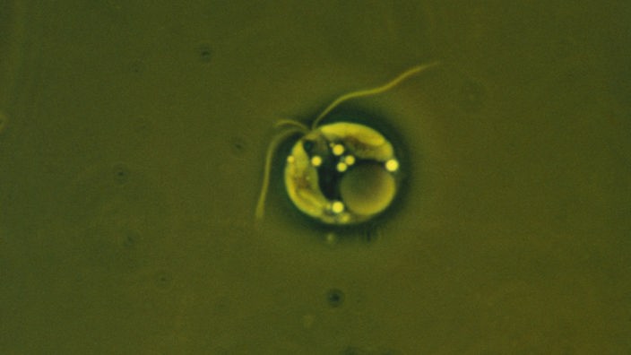 Nur wenige Tausendstel Millimeter groß: die Goldalge (Prymnesium parvum)