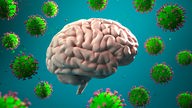Eine 3D-Darstellung eines von Coronaviren umgebenen Gehirns.
