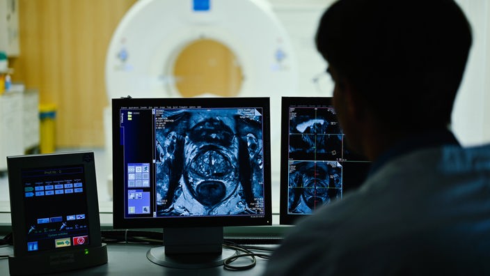 Ein Mitarbeiter des Deutschen Krebsforschungszentrums in Heidelberg erstellt ein CT einer Prostata 