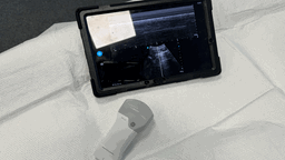 Notfallsanitäter bald mit Ultraschall unterwegs