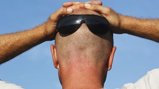 Ein männlicher Hinterkopf mit Sonnenbrille