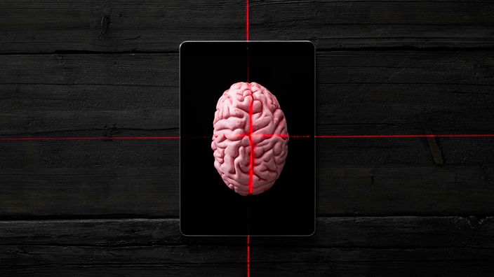 Ljudski mozak na Ipad-u