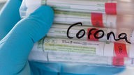Eine Person hält einen Beutel mit Corona-Tests in der Hand.