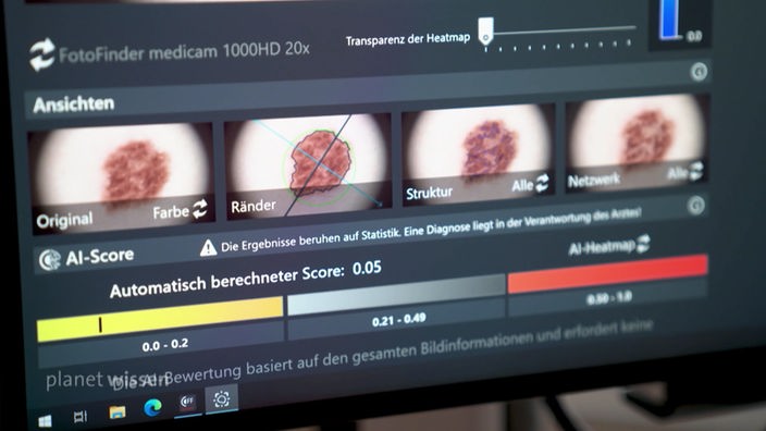 Monitor na kome AI vrši dijagnosticiranje u medicinske svrhe