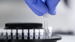 Laborant odlaže uzorke za dijagnostifikovanje virusa