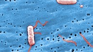 Legionella pneumophila Bakterien unter einem Mikroskop stark vergrößert
