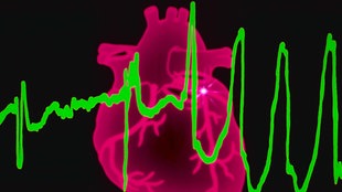 Symbolbild: EKG-Kurve vor der Grafik eines Herzens.