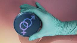 Eine Petrischale mit den Symbolen für Weiblichkeit und Männlichkeit. Symbolbild