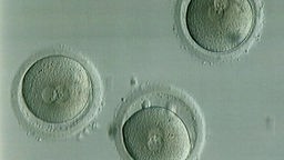 Das Foto zeigt drei befruchtete Eizellen mit Vorkernen im Zellinneren bei 200-facher Vergrößerung