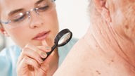 Eine Hautärztin untersucht mit der Lupe einen alten Menschen auf Hautkrebs 