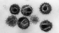 Eine undatierte elektronenmikroskopische Aufnahme zeigt mehrere Humane Immunschwäche-Viren (HIV)