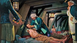 Arzt James Lind bei einem Patienten in einem Schiffslazarett (historisches Bild)