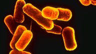 Escherichia coli Bakterien
