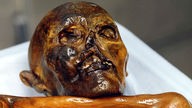 Schädel der Steinzeit-Mumie Ötzi