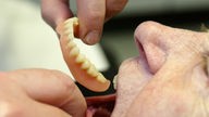 Ein Zahnarzt setzt einer Patientin eine Zahnprothese ein
