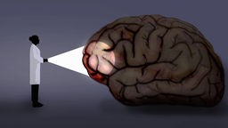 Grafik: Wissenschaftlerin beleuchtet ein überdimensional großes Modell eines menschlichen Gehirns