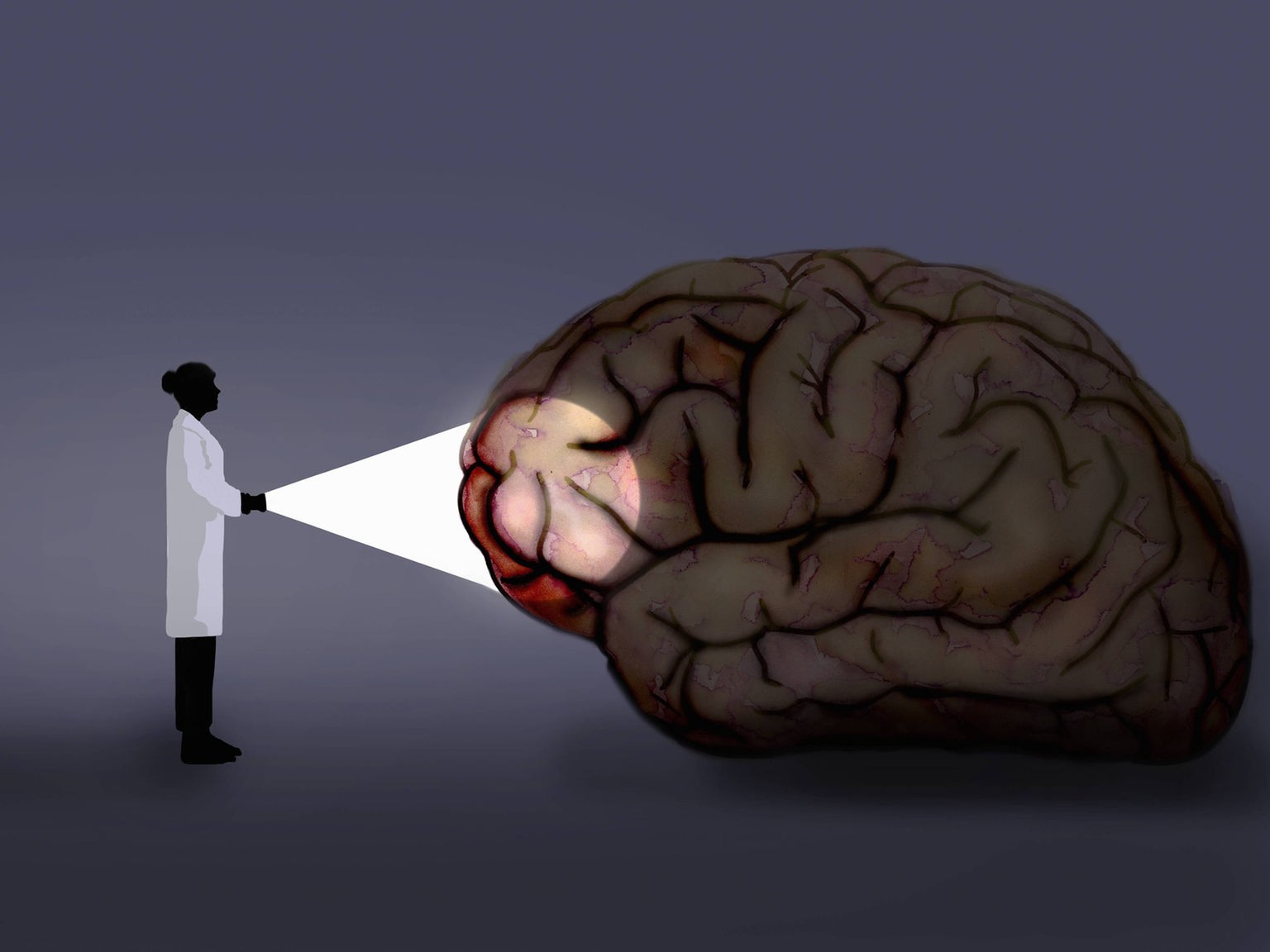 Wie groß ist das männliche Gehirn?