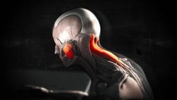 Ein Modell eines menschlichen Körpers mit einer rot hervorgehobenen, verspannten Nackenmuskulatur