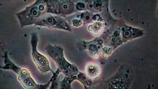 Usutu-Virus unter dem Mikroskop