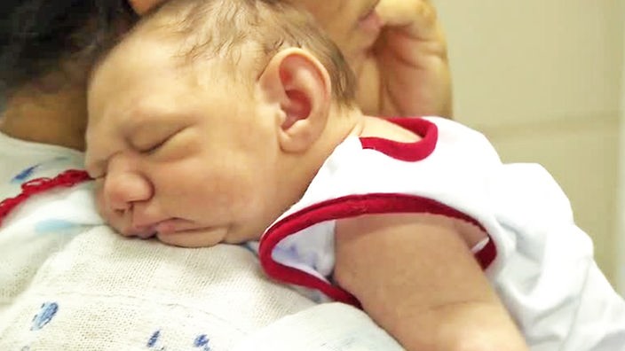 Ein Baby mit Mikrozephalie liegt auf dem Arm seiner Mutter.
